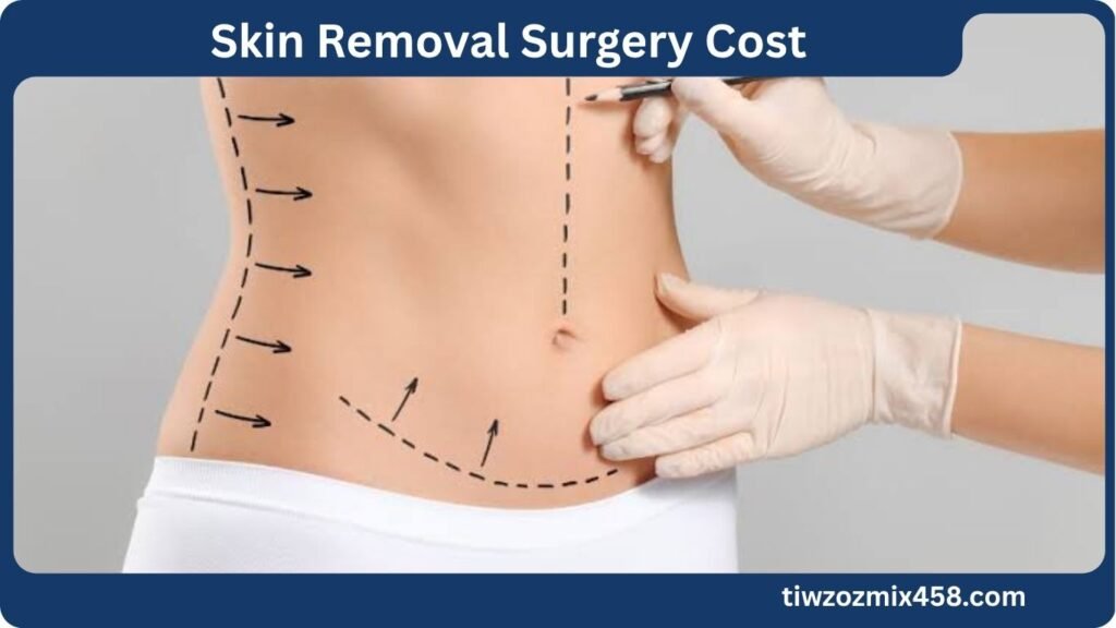 Skin Removal Surgery Cost